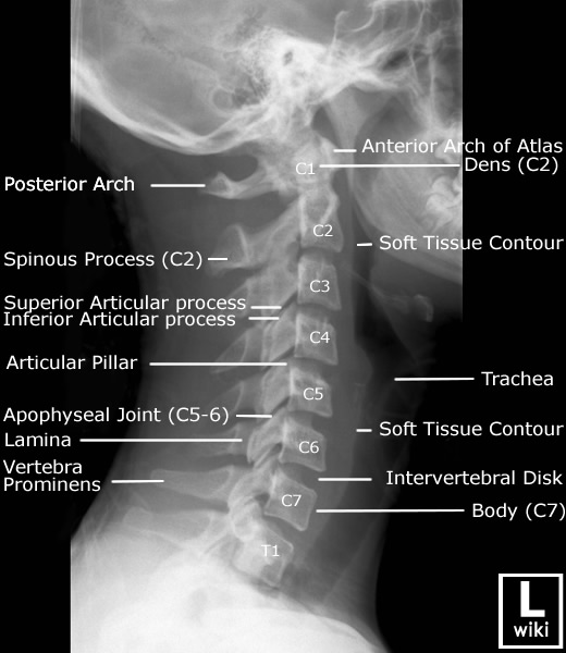 Cervical Spine Radiographic Anatomy Radiologypicscom