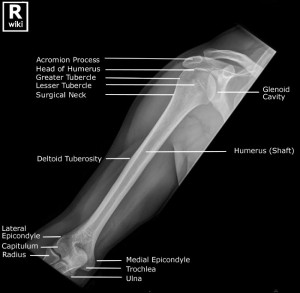 Frontal radiograph of the humerus with labels. 